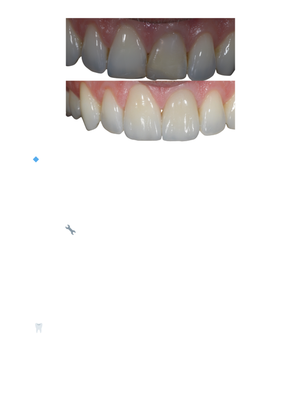 denti fissi senza paura (Riviste) (3)
